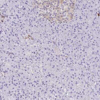 Immunohistochemistry-Paraffin: PPFIA4 Antibody [NBP2-31560]