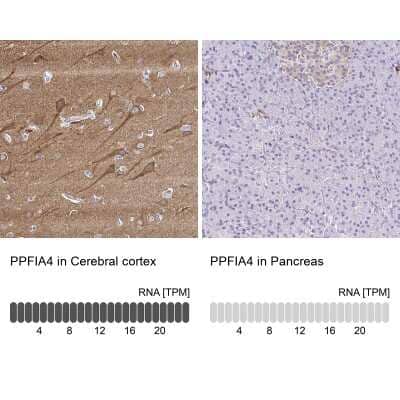 Immunohistochemistry-Paraffin: PPFIA4 Antibody [NBP2-31560]