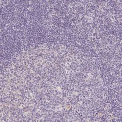 Immunohistochemistry-Paraffin: PPFIA4 Antibody [NBP2-31573]