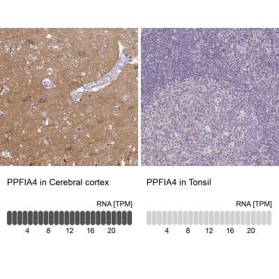 Immunohistochemistry-Paraffin: PPFIA4 Antibody [NBP2-31573]