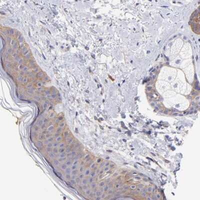 Immunohistochemistry-Paraffin: PPFIBP1 Antibody [NBP1-83192]