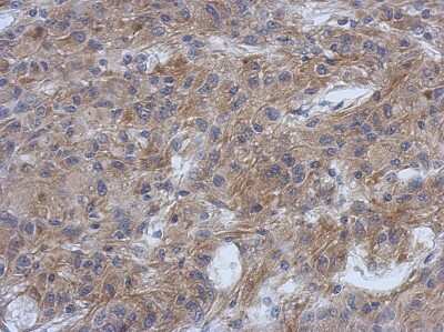 Immunohistochemistry-Paraffin: PPFIBP1 Antibody [NBP2-19898]