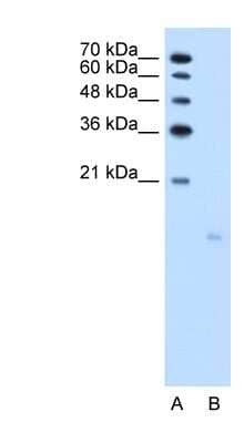 Western Blot: PPFIBP1 Antibody [NBP1-56315]