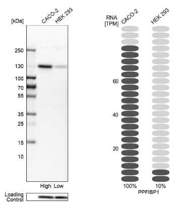 Western Blot: PPFIBP1 Antibody [NBP1-83192]