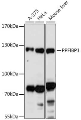 Western Blot: PPFIBP1 AntibodyAzide and BSA Free [NBP2-95188]