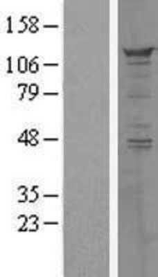 Western Blot: PPFIBP1 Overexpression Lysate [NBL1-14642]