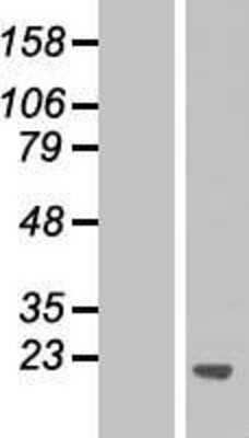 Western Blot: PPFIBP1 Overexpression Lysate [NBP2-05040]