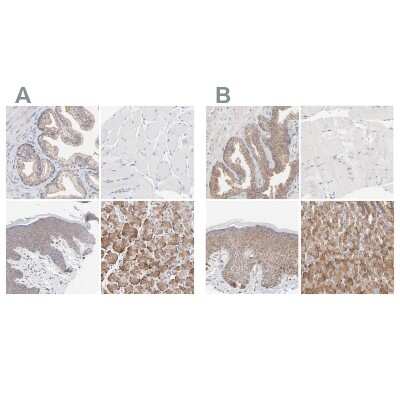 Immunohistochemistry-Paraffin: PPFIBP2 Antibody [NBP1-86575]