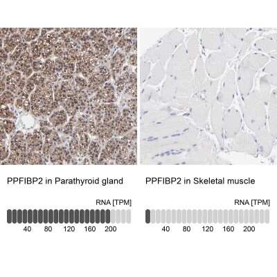 Immunohistochemistry-Paraffin: PPFIBP2 Antibody [NBP1-86575]