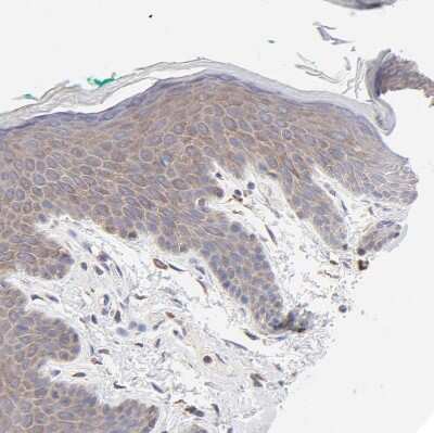 Immunohistochemistry-Paraffin: PPFIBP2 Antibody [NBP1-86575]