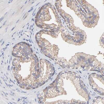 Immunohistochemistry-Paraffin: PPFIBP2 Antibody [NBP1-86575]