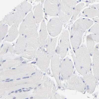 Immunohistochemistry-Paraffin: PPFIBP2 Antibody [NBP1-86575]