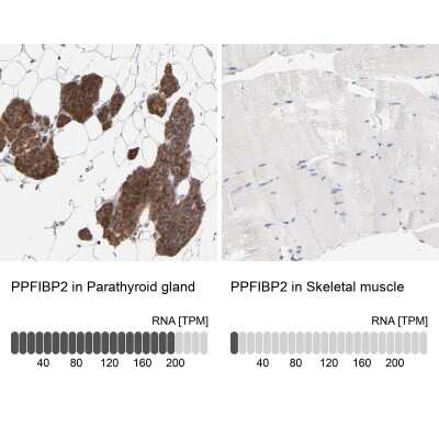 Immunohistochemistry-Paraffin: PPFIBP2 Antibody [NBP1-86576]