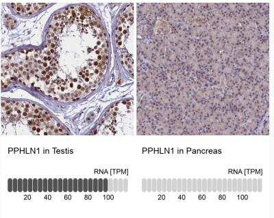 Immunohistochemistry-Paraffin: PPHLN1 Antibody [NBP1-89480]