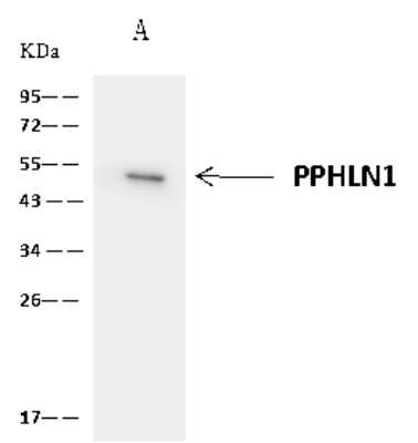Immunoprecipitation: PPHLN1 Antibody [NBP2-98653]