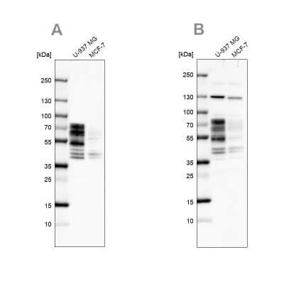 Western Blot: PPHLN1 Antibody [NBP2-38431]