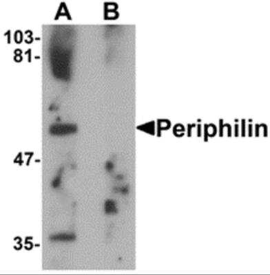 Western Blot: PPHLN1 AntibodyBSA Free [NBP2-81775]