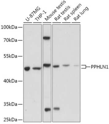 Western Blot: PPHLN1 AntibodyAzide and BSA Free [NBP2-94375]