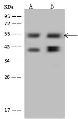 Western Blot: PPHLN1 Antibody [NBP2-98653]