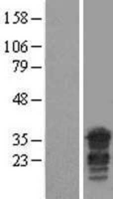 Western Blot: PPHLN1 Overexpression Lysate [NBL1-14644]