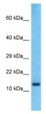 Western Blot: PPIAL4C Antibody [NBP3-09879]