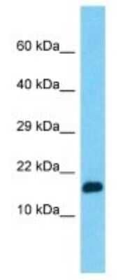 Western Blot: PPIAL4G Antibody [NBP3-09878]