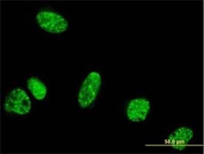 Immunocytochemistry/ Immunofluorescence: PPIG Antibody (4F8) [H00009360-M02]