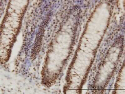 Immunohistochemistry-Paraffin: PPIG Antibody (4F8) [H00009360-M02]