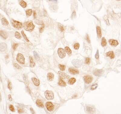 Immunohistochemistry: PPIG Antibody [NBP1-19116]