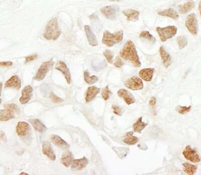 Immunohistochemistry: PPIG Antibody [NBP1-19117]