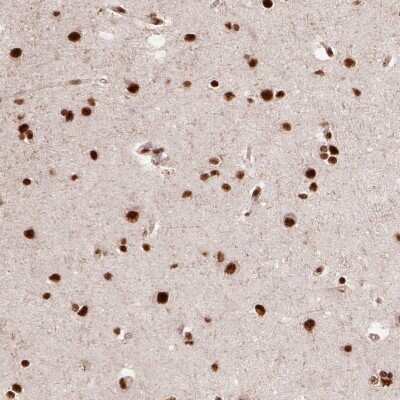 Immunohistochemistry-Paraffin: PPIG Antibody [NBP2-49256]