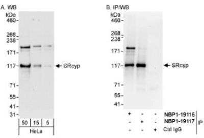 Western Blot: PPIG Antibody [NBP1-19116]