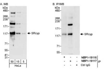 Western Blot: PPIG Antibody [NBP1-19117]