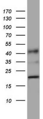 Western Blot: PPIH Antibody (OTI1C6) [NBP2-45381]