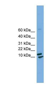 Western Blot: PPIH Antibody [NBP1-55448]