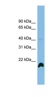 Western Blot: PPIH Antibody [NBP1-57630]