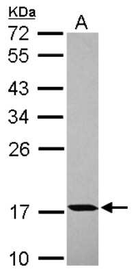 Western Blot: PPIH Antibody [NBP2-19899]