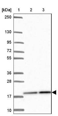 Western Blot: PPIH Antibody [NBP2-32416]