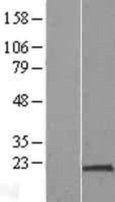 Western Blot: PPIH Overexpression Lysate [NBL1-14650]