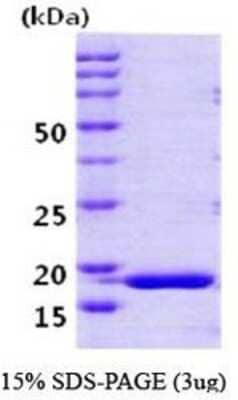 SDS-PAGE: Recombinant Human PPIH Protein [NBC1-18434]