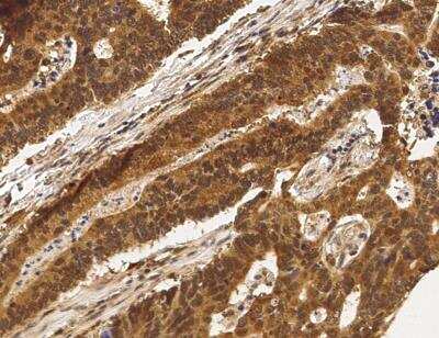 Immunohistochemistry-Paraffin: PPIL1 Antibody (003) [NBP2-90270]