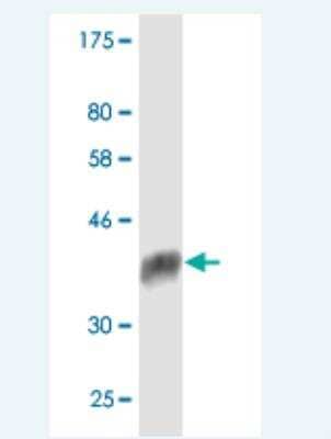 Western Blot: PPIL1 Antibody (1B5) [H00051645-M03]