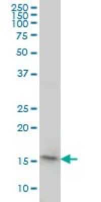 Western Blot: PPIL1 Antibody (2C2) [H00051645-M01]