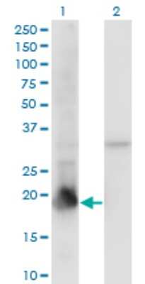 Western Blot: PPIL1 Antibody (2C2) [H00051645-M01]