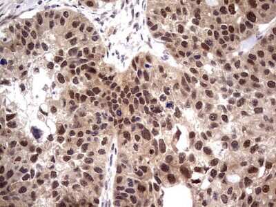 Immunohistochemistry: PPIL1 Antibody (OTI2D1) [NBP2-45382]