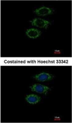 Immunocytochemistry/ Immunofluorescence: PPIL1 Antibody [NBP2-15080]