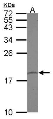 Western Blot: PPIL1 Antibody [NBP2-15080]