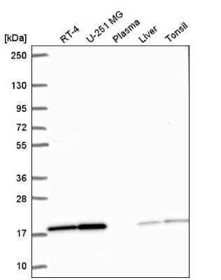 Western Blot: PPIL1 Antibody [NBP2-57062]