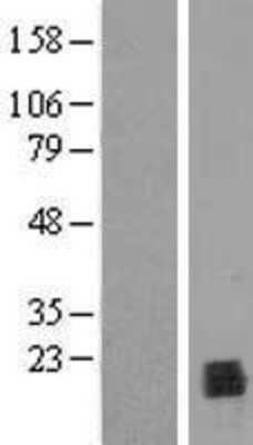 Western Blot: PPIL1 Overexpression Lysate [NBL1-14651]