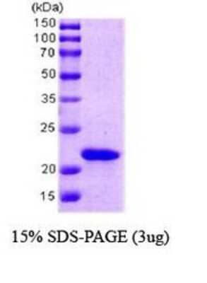 SDS-PAGE: Recombinant E. coli PPIL1 Protein [NBC1-18375]